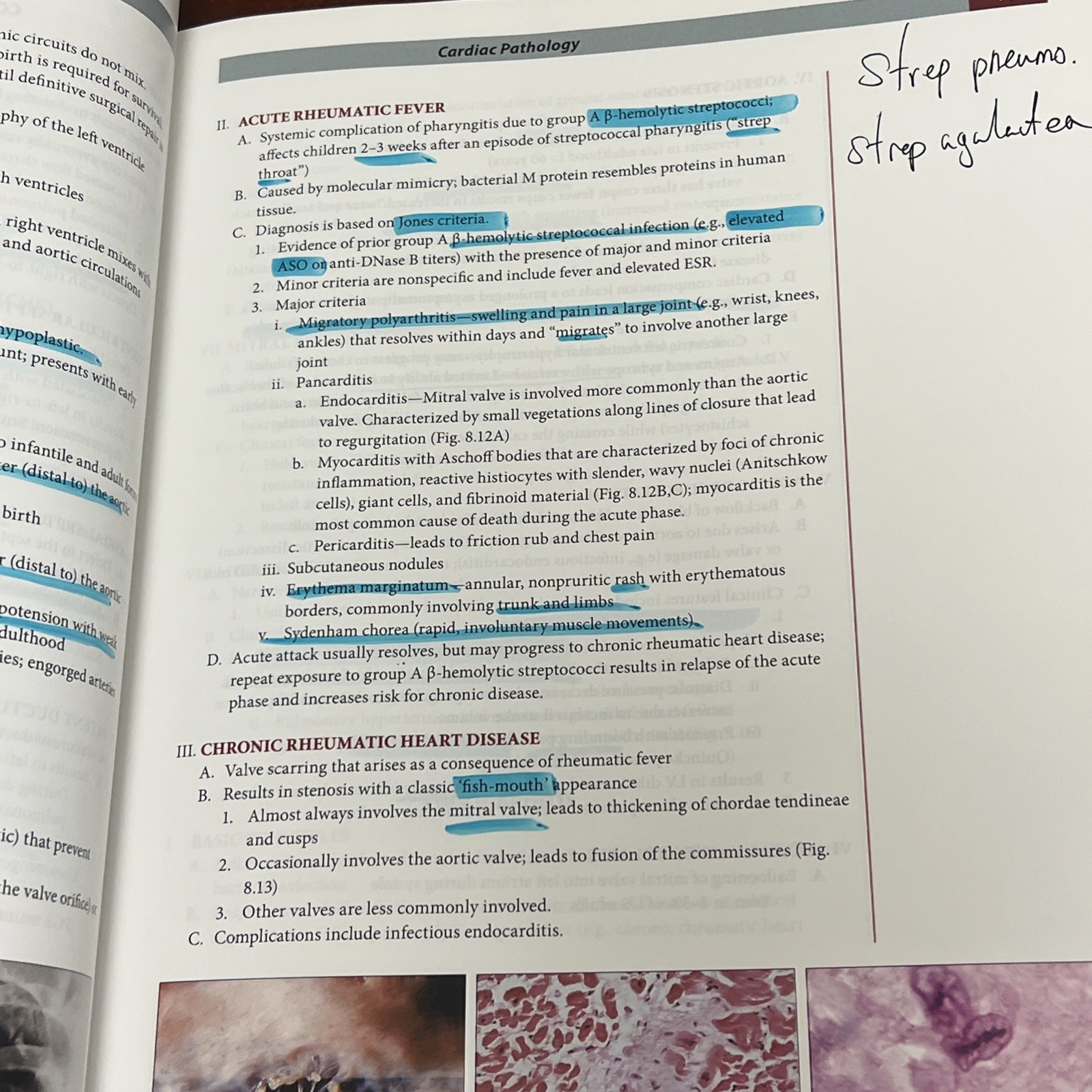 Fundamentals of Pathology by Husain A. Sattar (Trade Paperback)