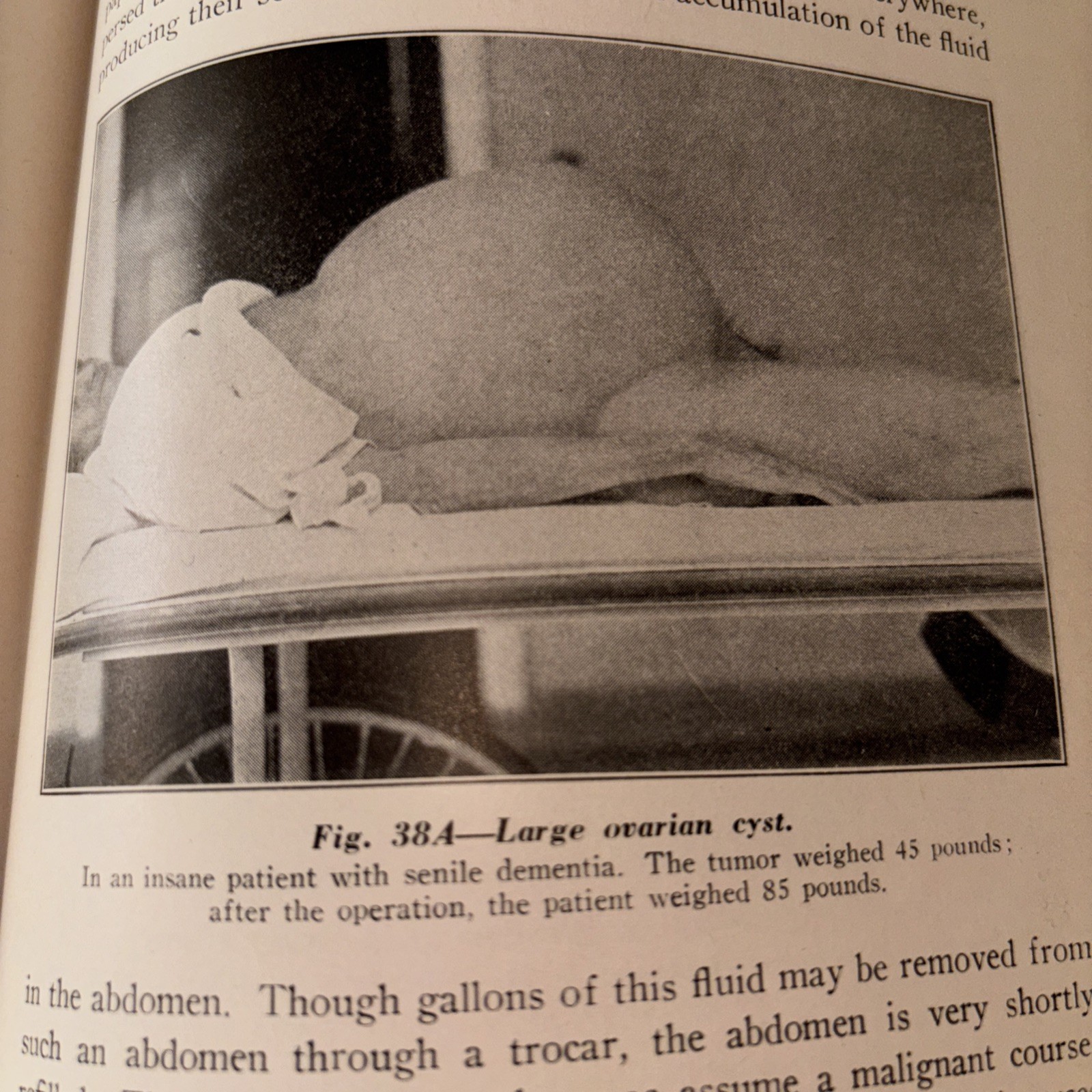 Text Book of pathology 1945, 5th Edition, Illustrated